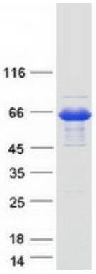 Coomassie blue staining of purified AKT1 protein.